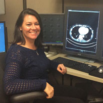 Stephanie M. Simonson, MD, Radiologist