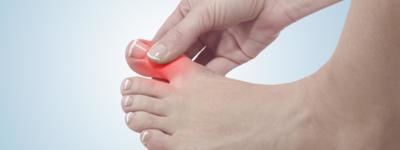 does starting allopurinol prolong acute treated gout