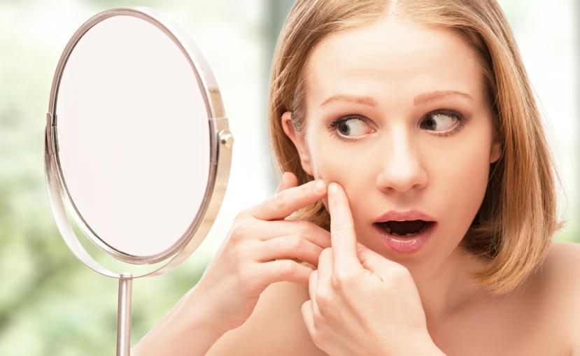 An Overview of Prescription Medications and Natural Remedies for Acne