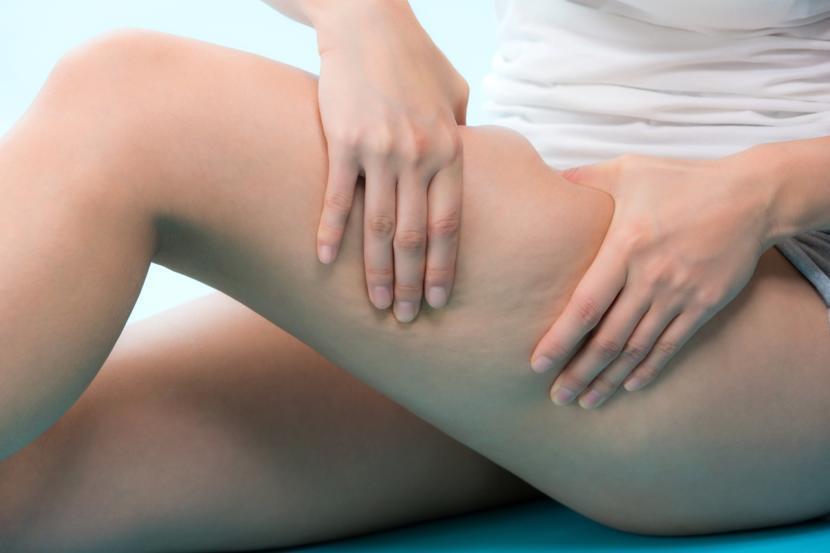 How Can I Get Rid of Cellulite?