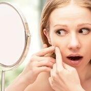 How do I Get Rid of Blackheads?