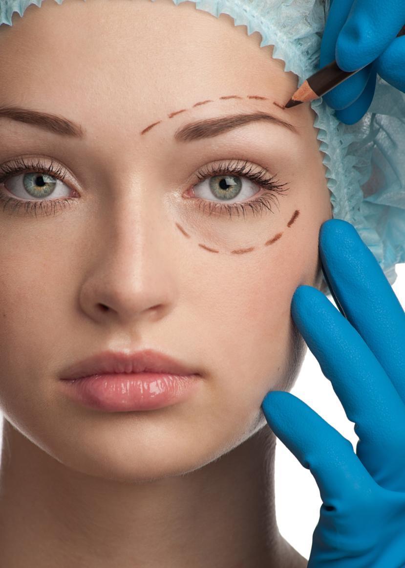 Reasons Why You Need a Blepharoplasty