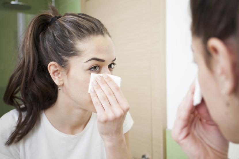 Understanding Acne and Its Causes