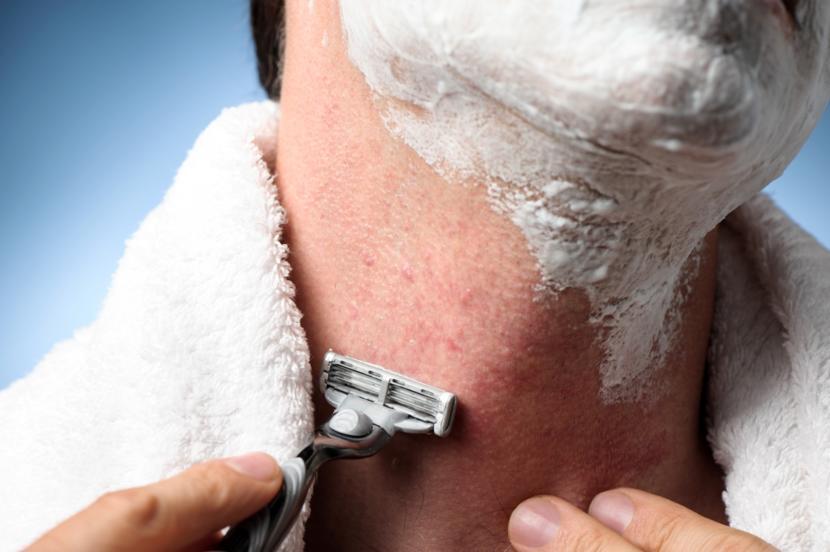What are the Signs and Symptoms of an Ingrown Hair?