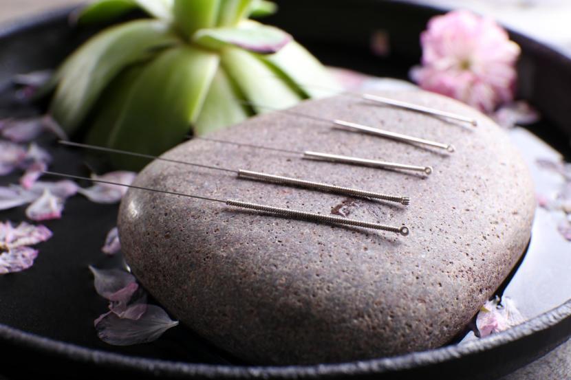 Acupuncture Facts: Questions & Answers