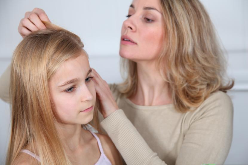 5 Tips for Dealing with Head Lice
