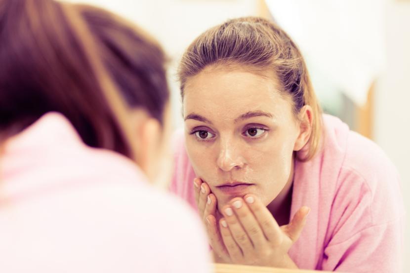 Alternative Treatments for Acne