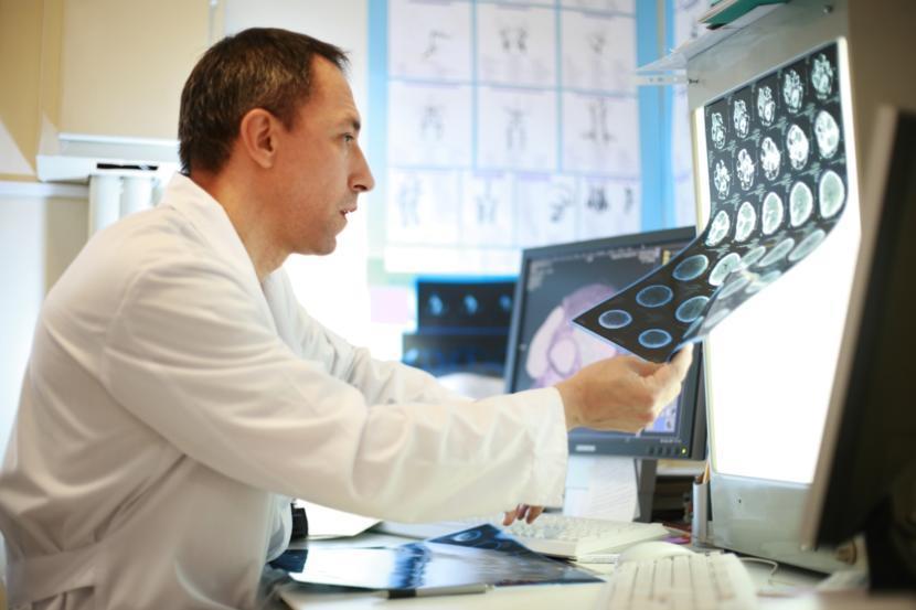 Researching Brain Changes in Multiple Sclerosis
