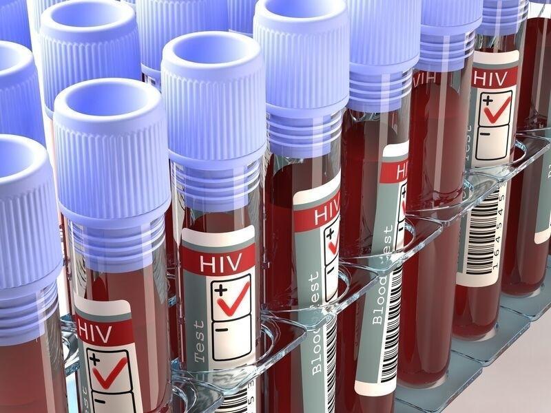 Can I Live with HIV?
