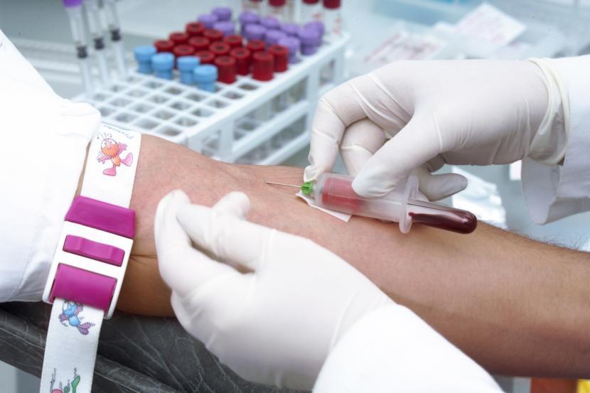 Can Lab Tests Help Reach a Diagnosis for Multiple Sclerosis?