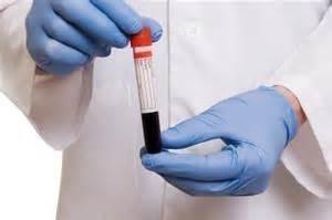 Celiac Disease: Get Diagnosed