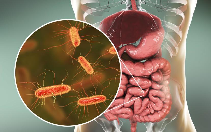 Eradicating H. Pylori Infections Is Key for Parkinson's Disease, Study Suggests