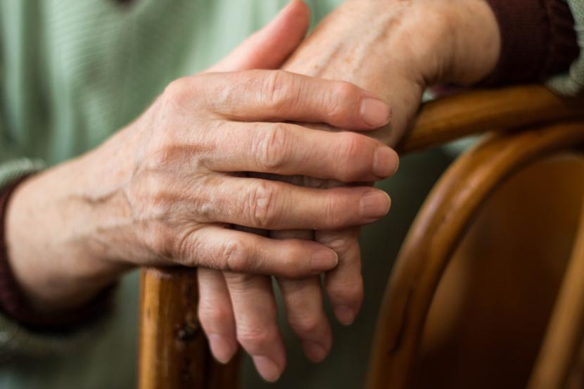 The History of Rheumatoid Arthritis
