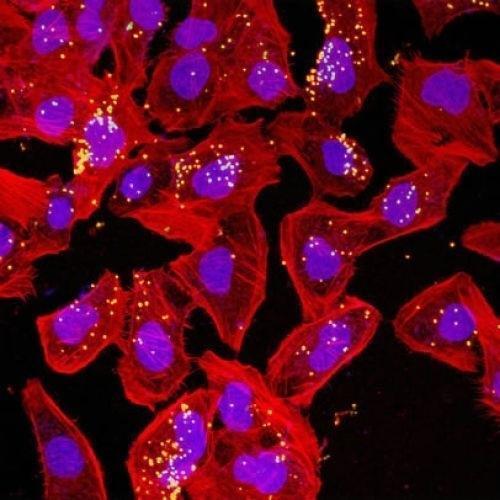 How to Treat Meningitis