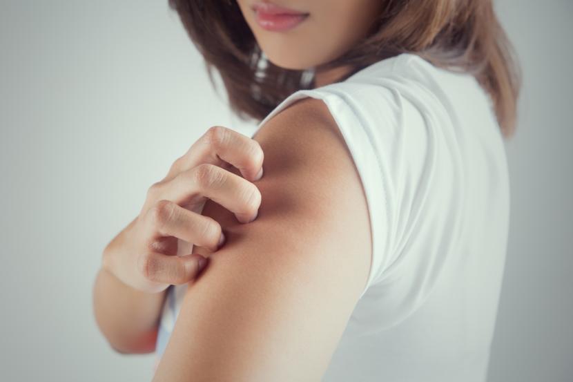 Is it Heat Rash or Folliculitis?