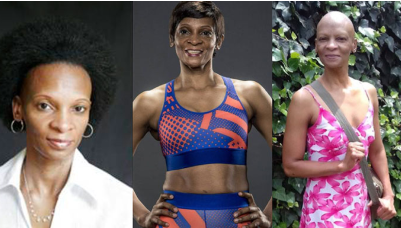 Mali Ramara's Story: Turning Hair Loss Into A Source of Strength