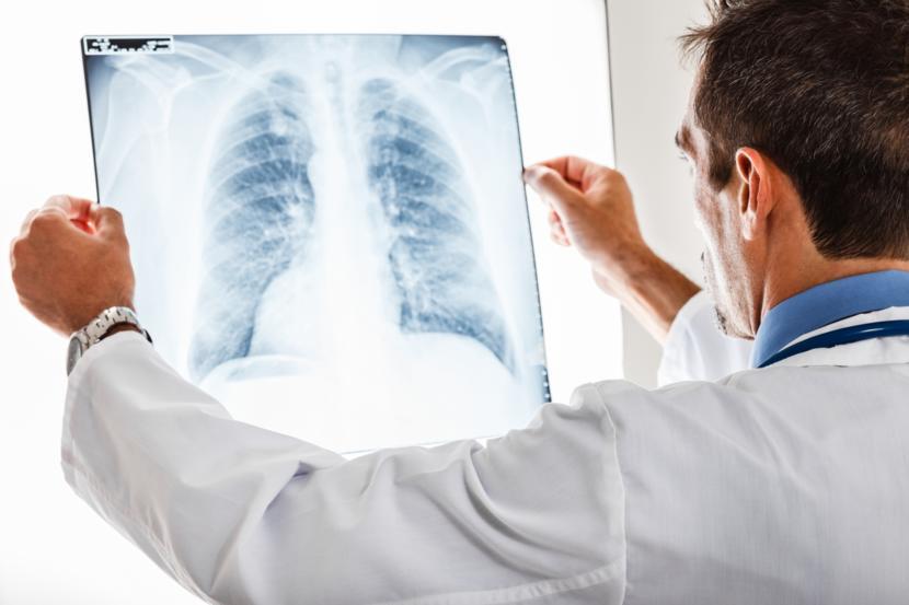 Pneumonia: Are There Multiple Types?