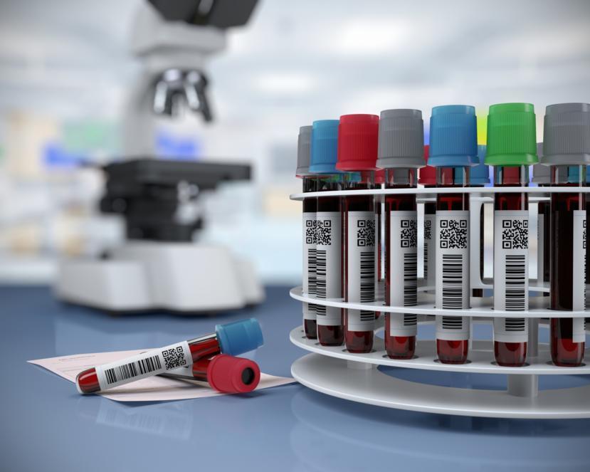 Study Discovers Fatality Predictors in Duchenne Muscular Dystrophy