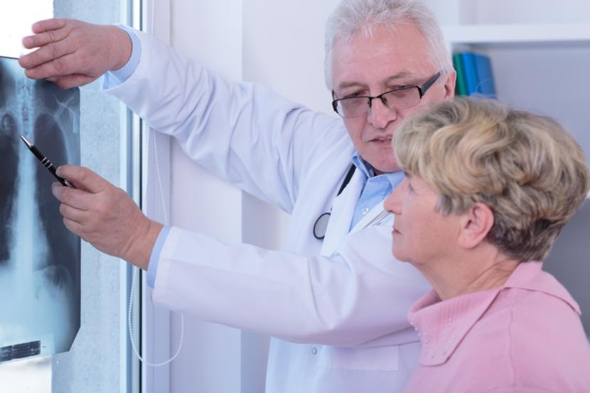 Rheumatoid Arthritis's Impact on the Lungs and How to Protect Them
