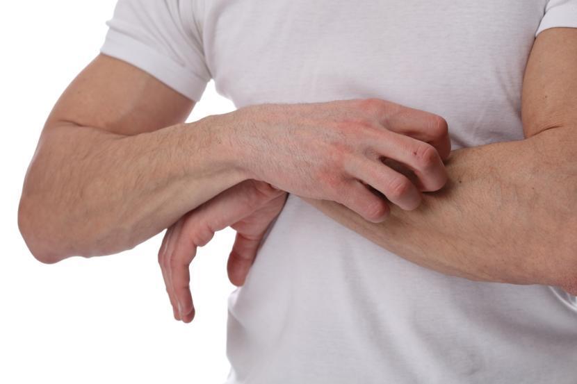 Ringworm Treatment: Type of Treatment and Natural Home Remedies