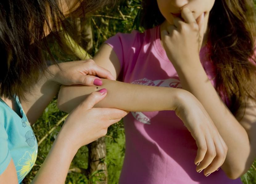 What Are the Causes and Symptoms of Rocky Mountain Spotted Fever?