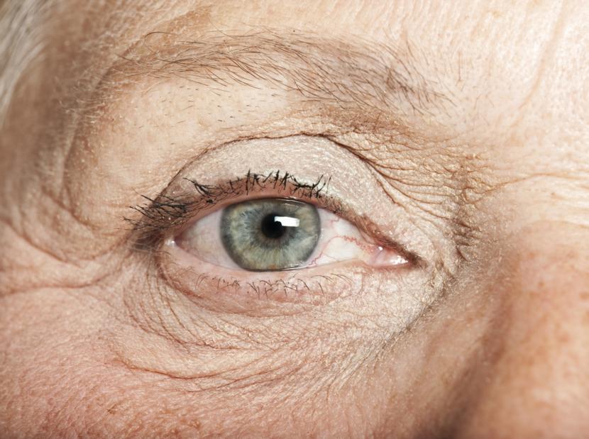What are the Different Stages of Alzheimer's Disease?