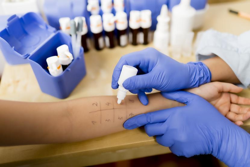 What Are the Different Types of Allergy Tests?