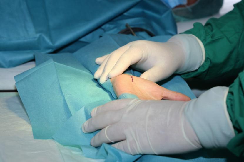 What Are the Risks of Carpal Tunnel Surgery?