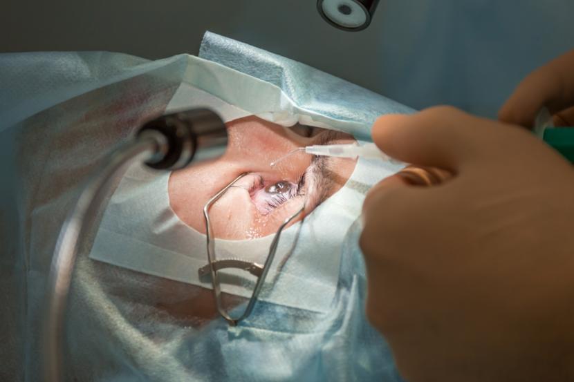 What are the Side Effects of Lasik Eye Surgery?