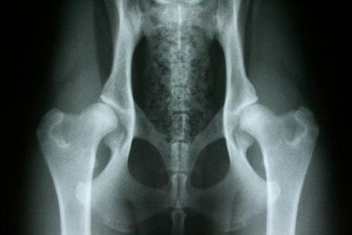 What Conditions are Associated with Hip Pain?