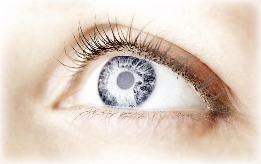 What is Age-Related Cataracts?