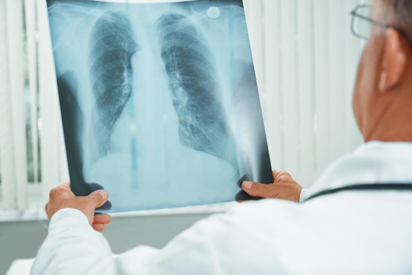 What Is an X-Ray?