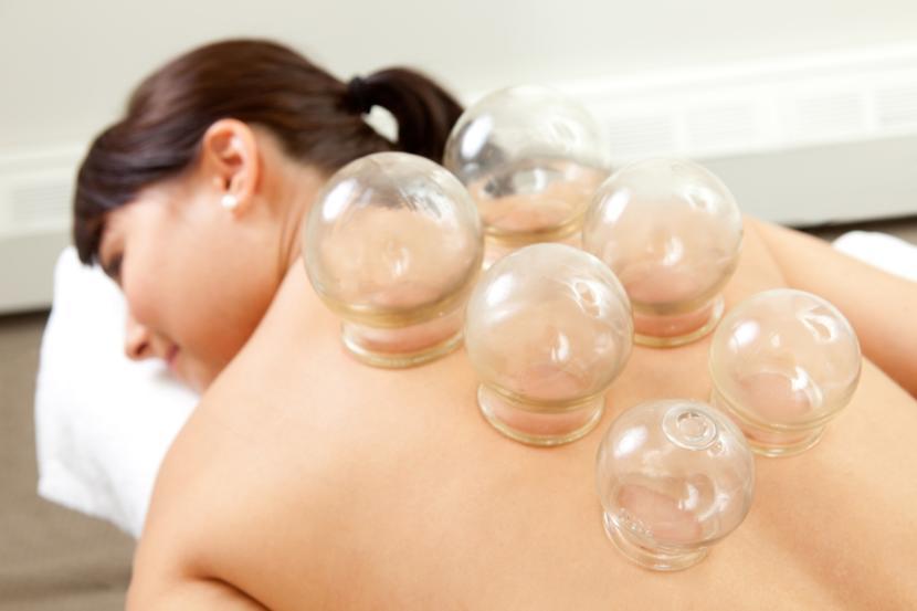 What is Cupping Therapy?