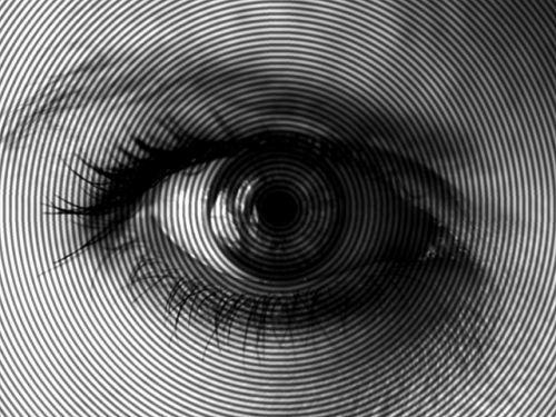 What is Keratoconus?