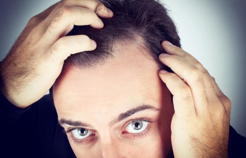 What is Scalp Psoriasis?