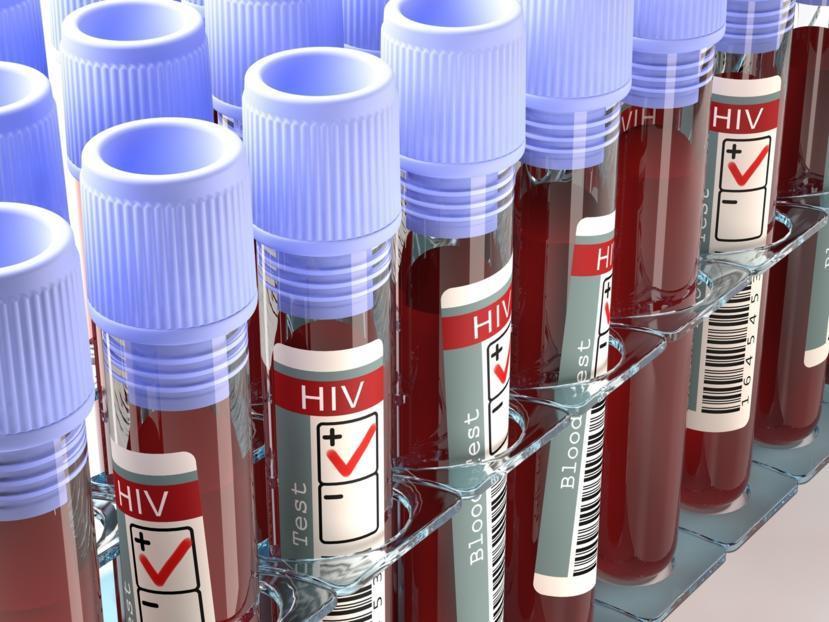 What Is the Difference Between AIDS and HIV?