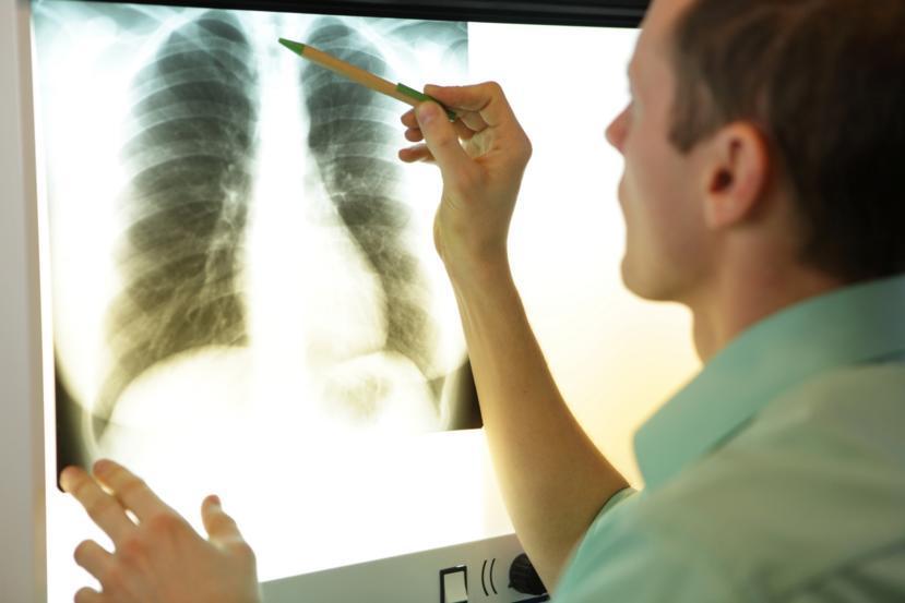 What Is the Xiphoid Process?