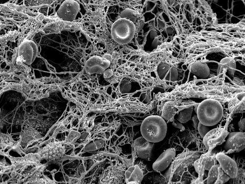 What Should I Know About Blood Clots?