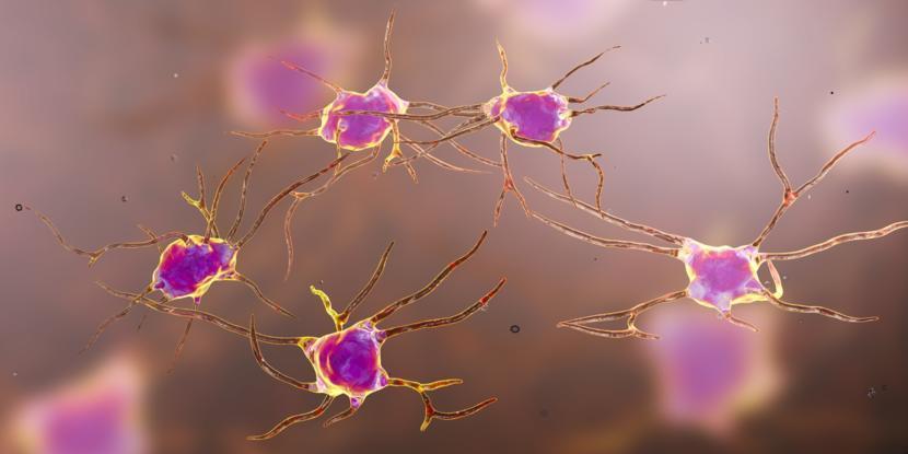 Researchers Understand More About Why Brain Cells Die in Parkinson's Disease