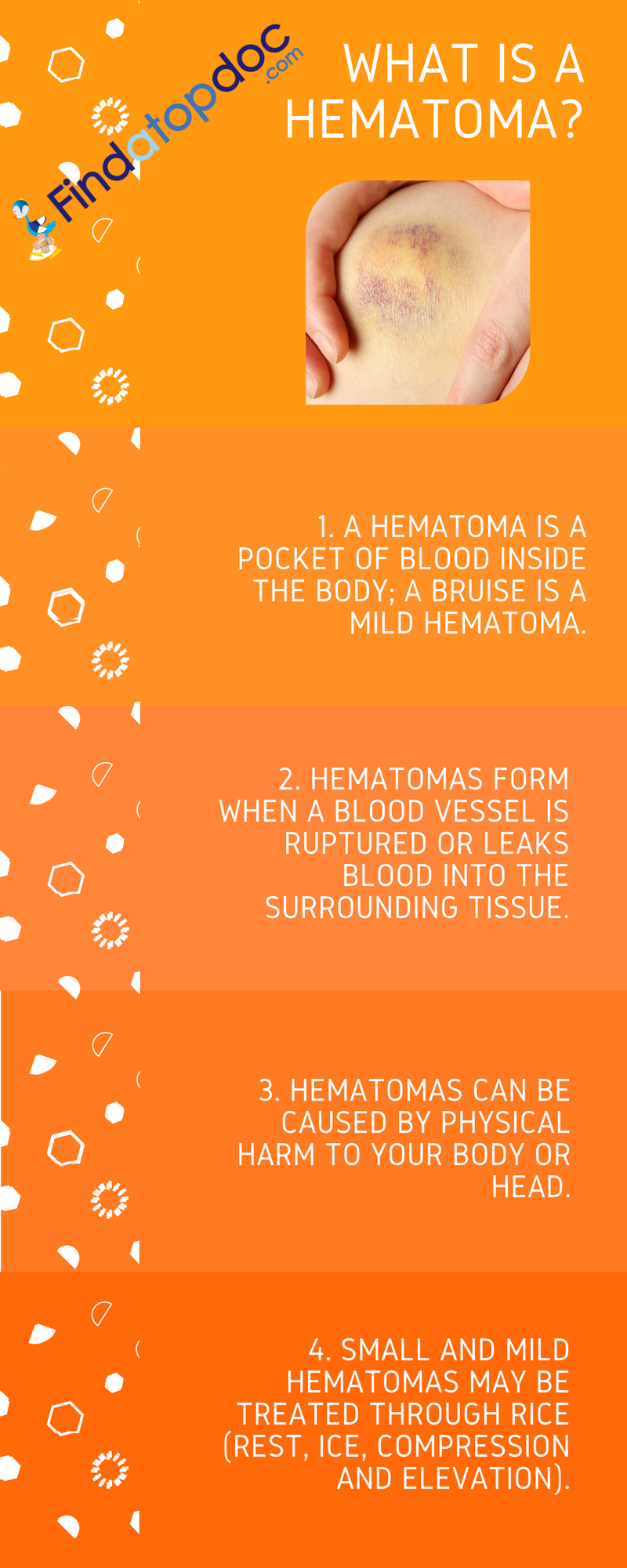 Hematoma Symptoms Causes Treatment And Diagnosis Findatopdoc