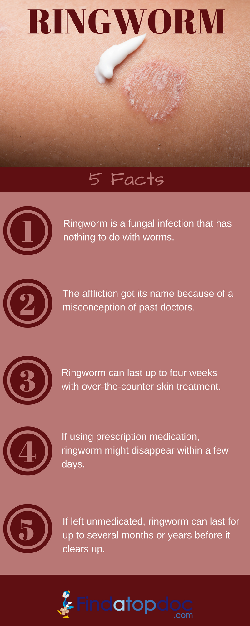 what is the best medication for ringworm infection