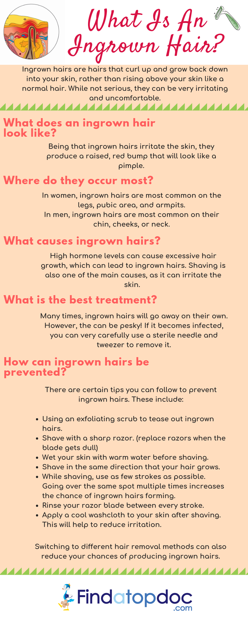Ingrown Pubic Hair On Vagina Causes Treatment And Prevention