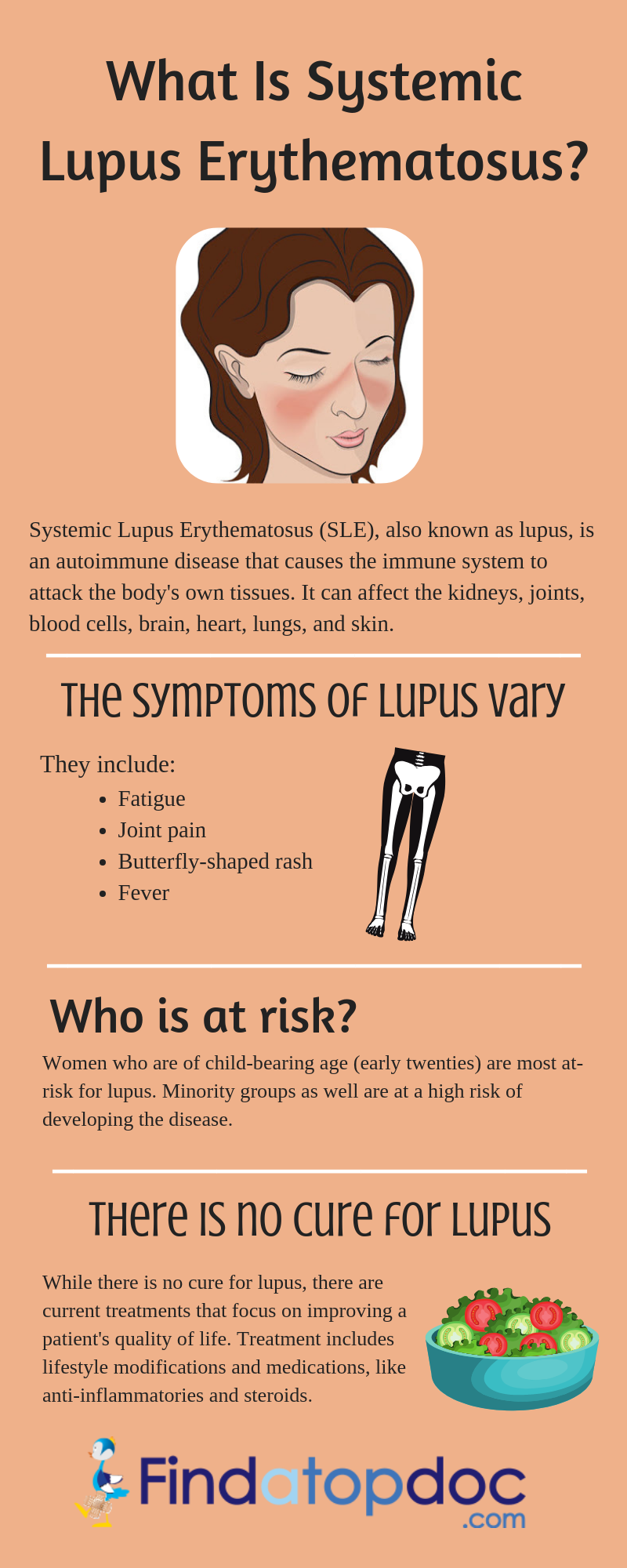 lupus headaches