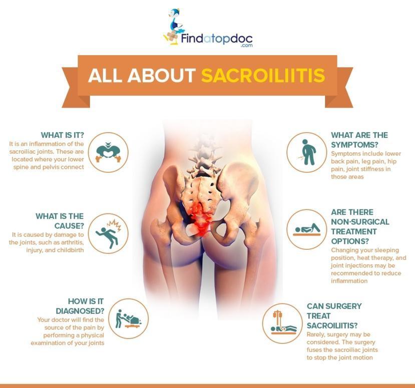 patron manifestation Zealot What Is Sacroiliitis: Causes, Symptoms, and Home Remedies