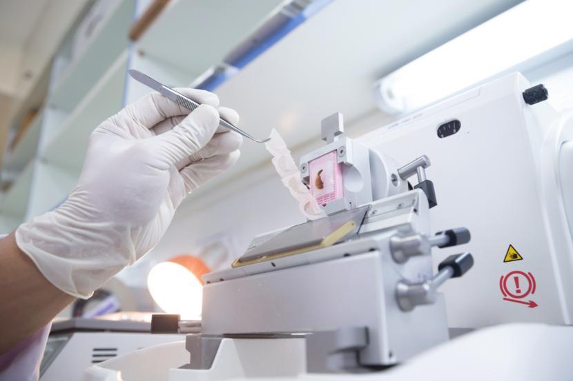 Everything You Need to Know About Biopsy Procedures