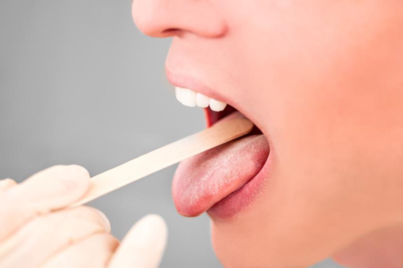Reasons Why You Need a Tonsillectomy