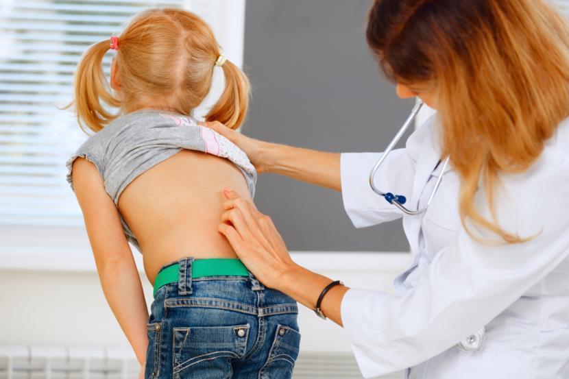 Scoliosis Symptoms and Causes