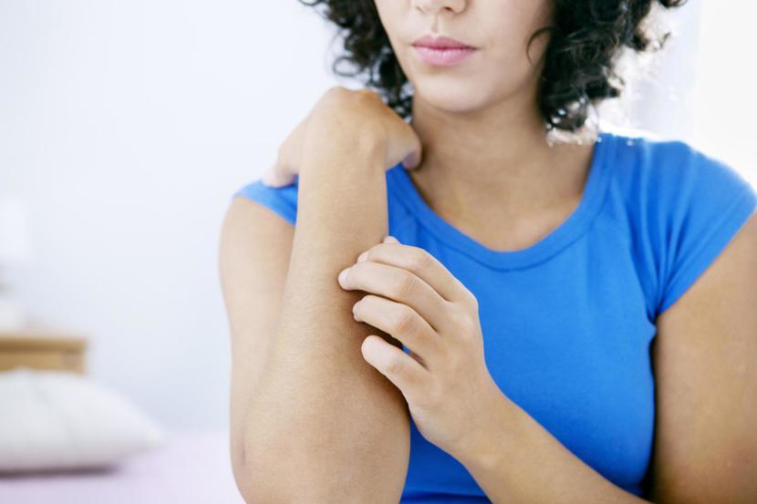 Ringworm of the Body and Scalp: Causes, Symptoms, Treatment