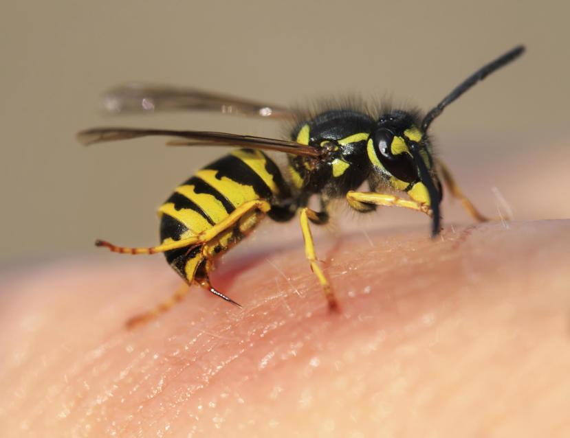 Wasp Stings