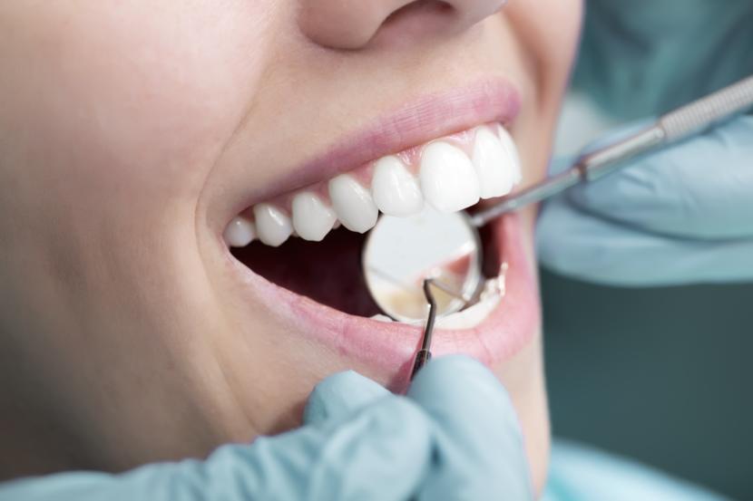 Is It Safe to Go to the Dentist While Pregnant?